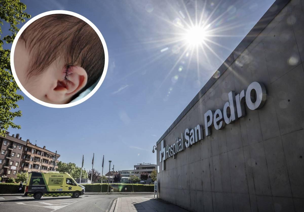 Reclaman una indemnización por los daños en la oreja de su bebé durante una cesárea en el San Pedro