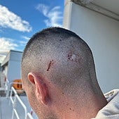 Kike Royo, recuperado tras la conmoción: «Fue un susto gordo»