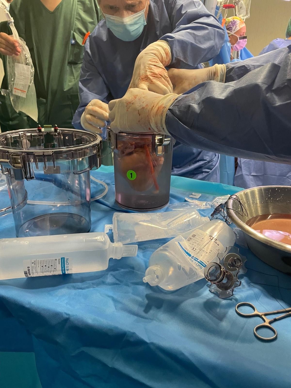 El corazón de la donación en asistolia, en un momento de la intervención.