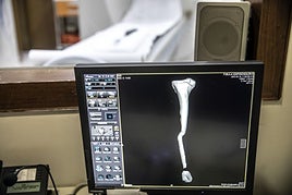 Muere un hombre tras ser absorbido por una máquina de resonancia magnética por llevar puesta una cadena metálica