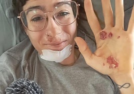 Sheyla Gutiérrez muestra sus heridas en sus redes sociales.