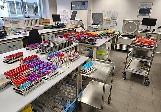 Muestras sin procesar acumuladas en un laboratorio tras la primera jornada de huelga de los técnicos superiores sanitarios.