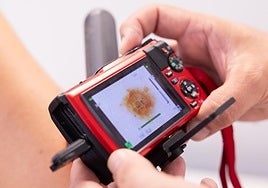 Un profesional sanitario de Atención Primaria revisa la piel de un paciente con las herramientas de teledermatología, en una imagen de archivo.