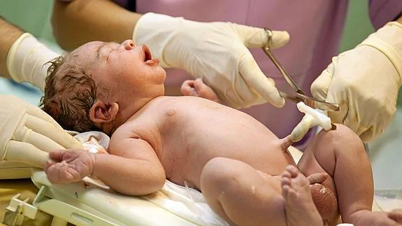 Un especialista sanitario corta el cordón umbilical a un bebé recién nacido.
