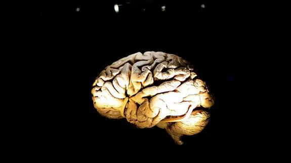 Un nuevo atlas del cerebro podría ayudar al estudio del párkinson y el alzhéimer