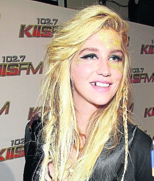 La cantante americana Kesha. 