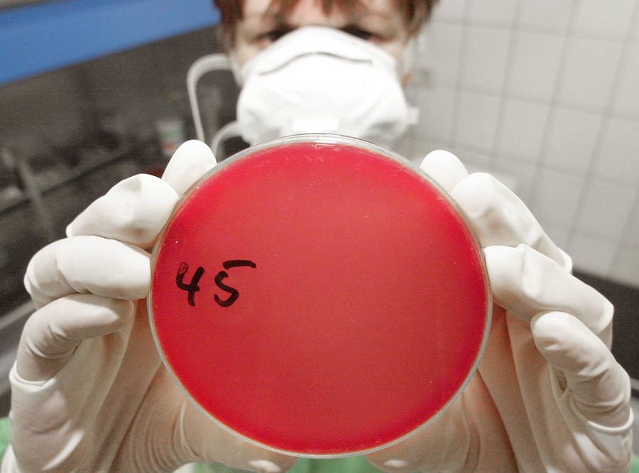 Una científica muestra un cultivo de bacterias alimentarias. 