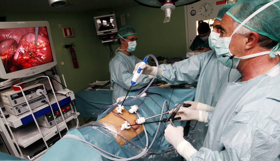 Intervención quirúrgica con sistema de laparoscopia. 
