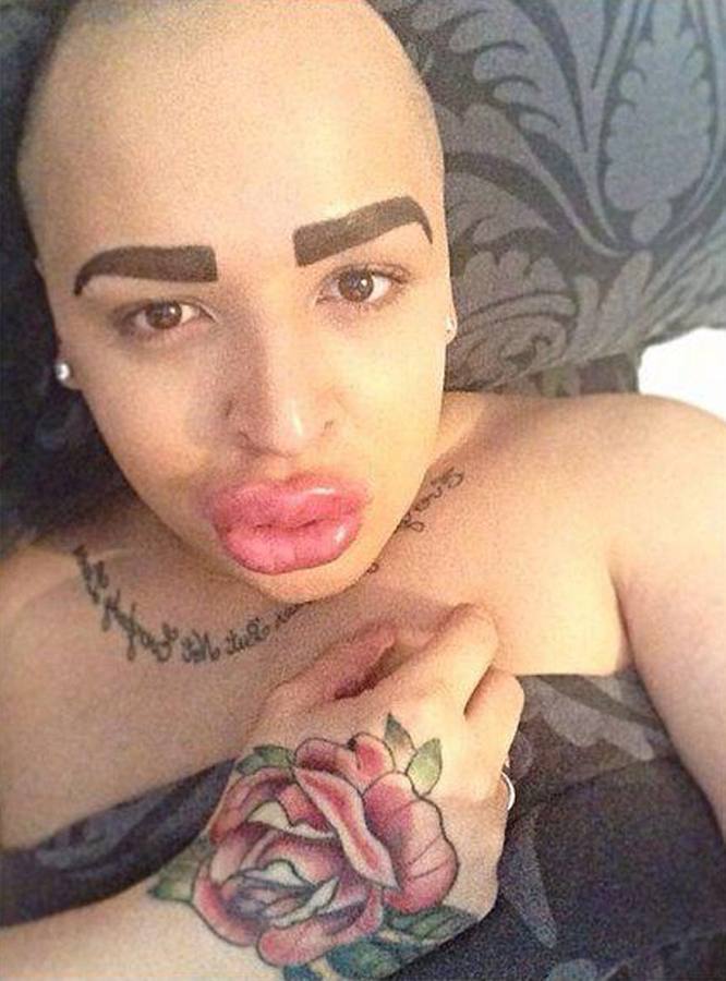 Se gasta 121.000 euros para parecerse a Kim Kardashian