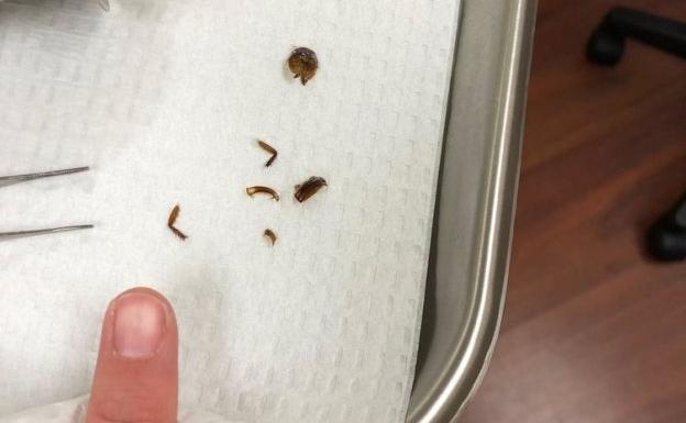 Partes de la cucaracha encontrada en el oído de la joven.