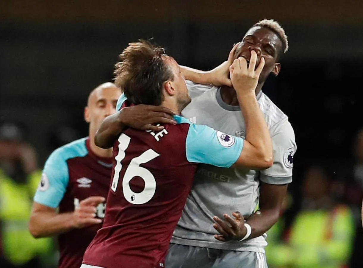 Fotos: Pogba y Noble se enzarzan en una fea pelea