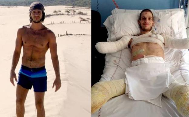 Davide Morana, antes y después de la enfermedad.