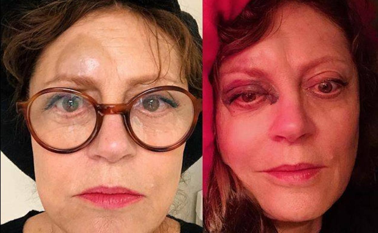 Fotografías del rostro de Susan Sarandon tras sufrir un pequeño accidente, colgadas por ella misma en sus redes sociales.