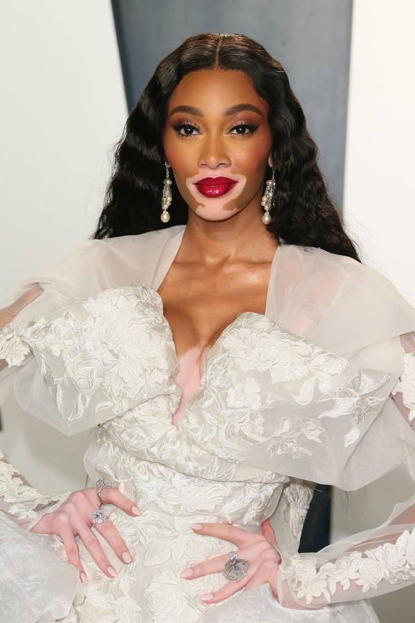 Winnie Harlow