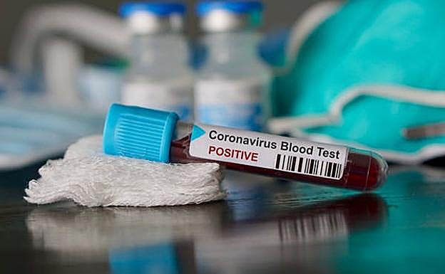 Los test aleatorios serían un método ideal. 