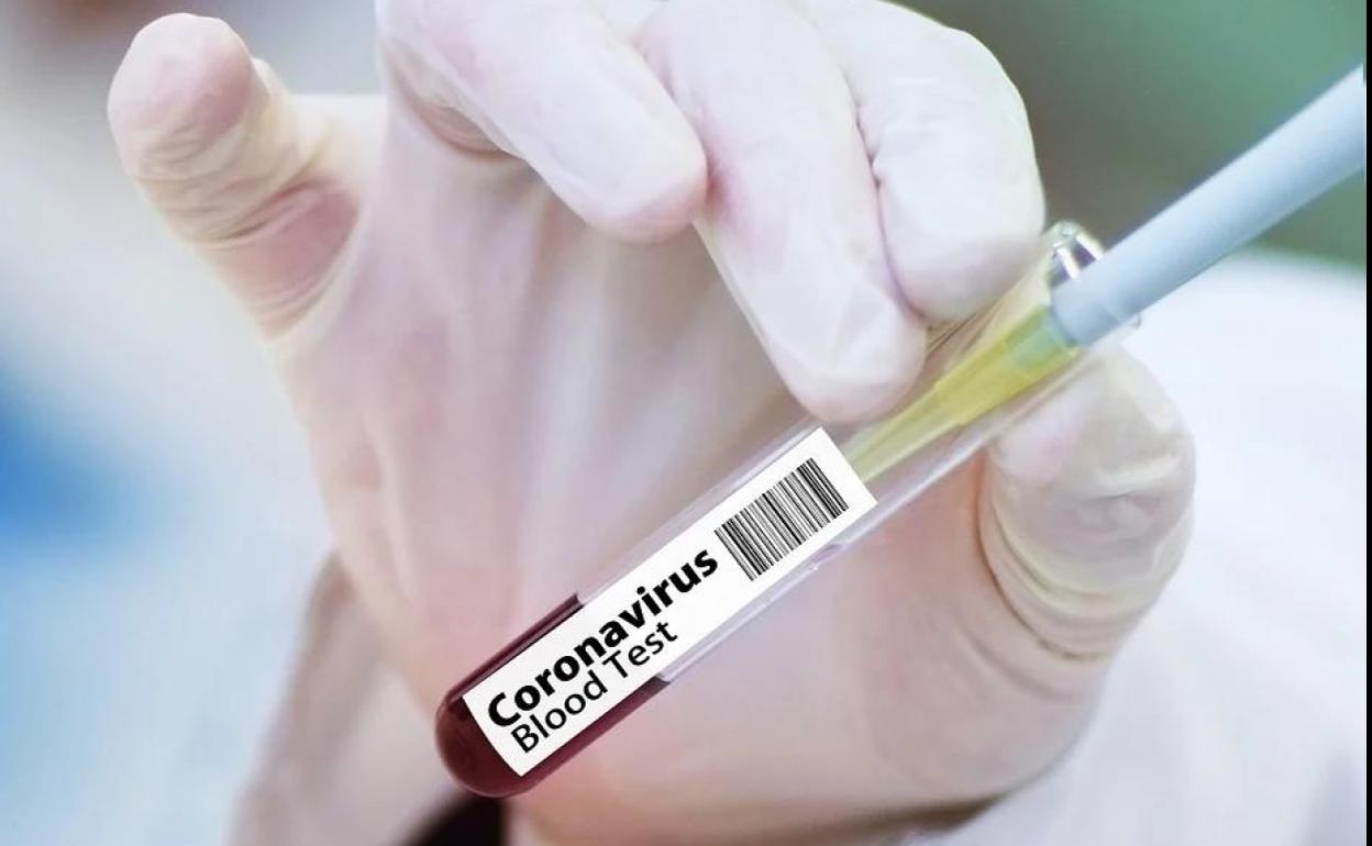 Probar la vacuna del coronavirus en ancianos y minorías étnicas es «clave», según un experto