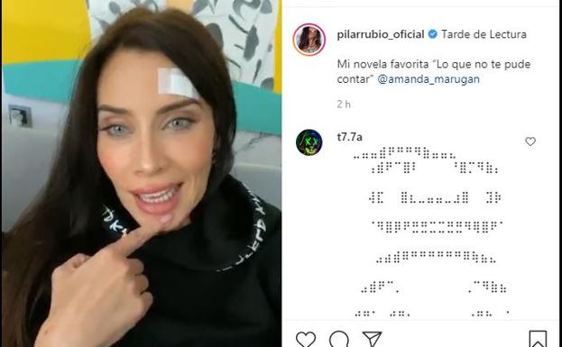 Una de las publicaciones de Pilar Rubio en Instagram con el apósito en la frente. 