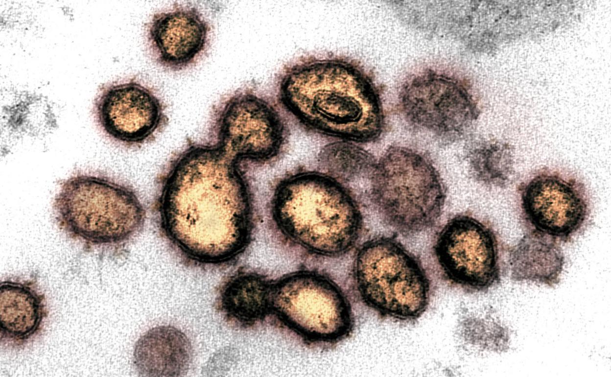 Imagen del coronavirus SARS-CoV-2, causante del COVID-19, tomada con microscopio electrónico, aislado a partir de una muestra . 