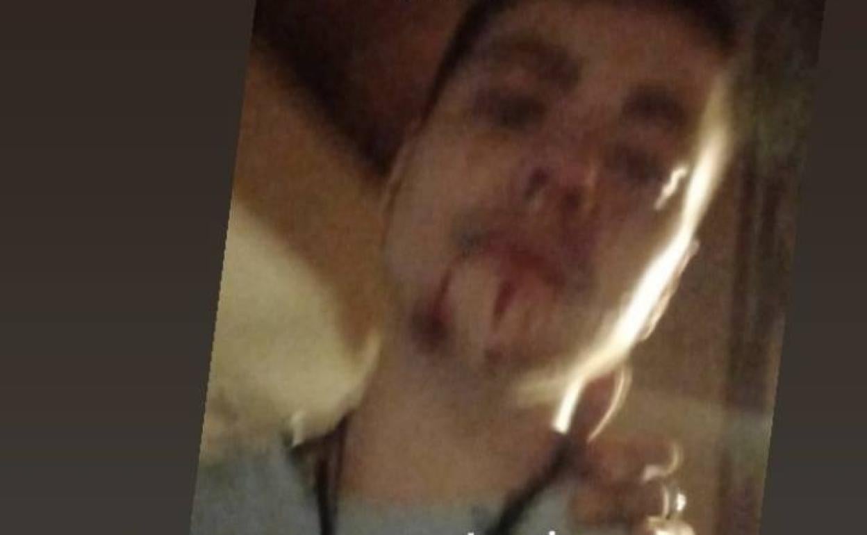El joven trans denuncia en redes sociales la paliza en Valencia. 