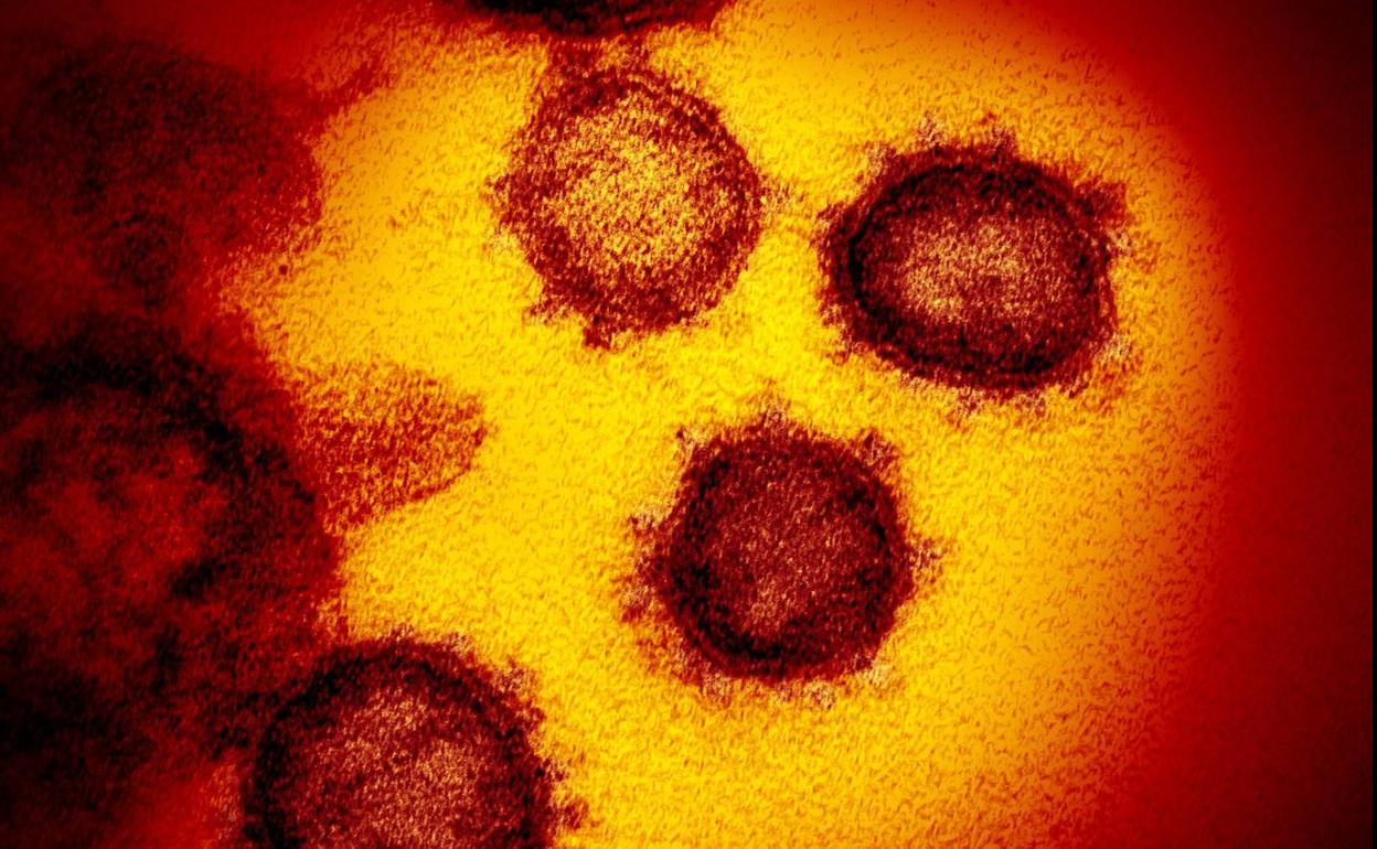 Imagen del coronavirus SARS-CoV-2, causante del COVID-19