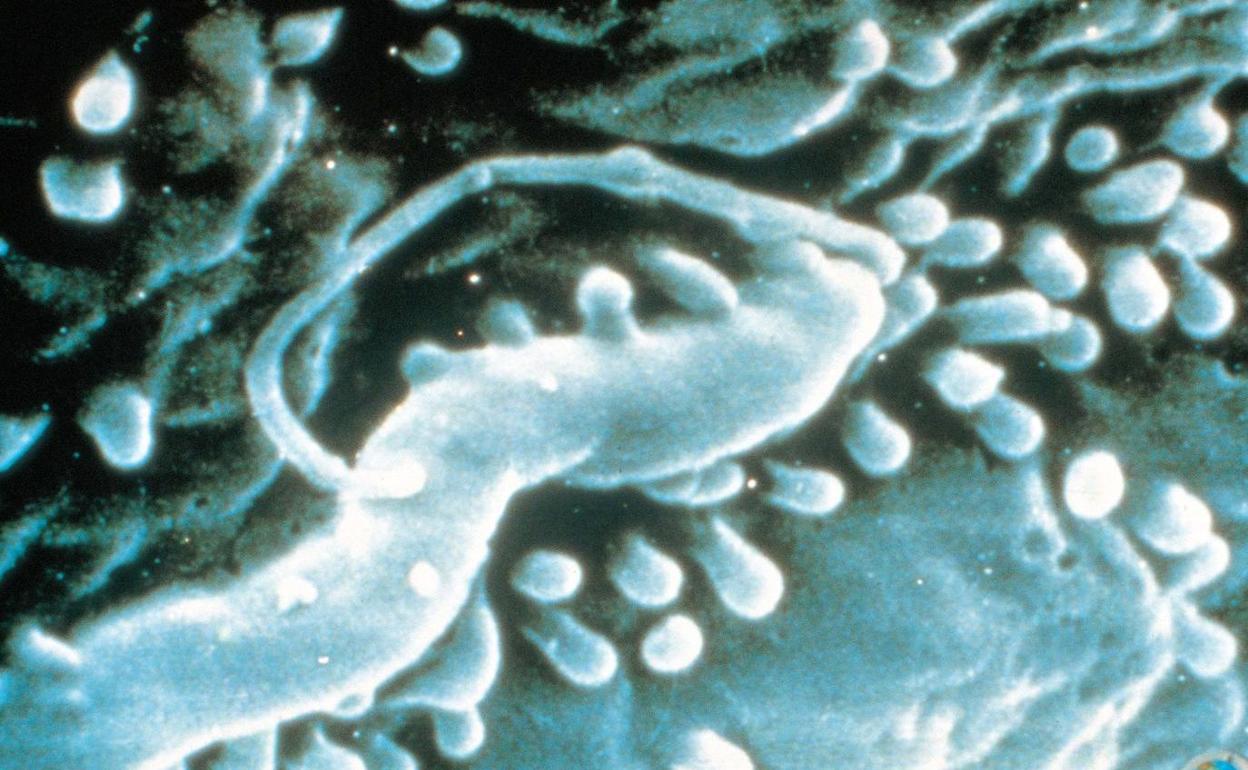 Helicobacter pylori (H. pylori). 