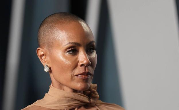 Jada Pinkett Smith ha sufrido problemas de alopecia. 