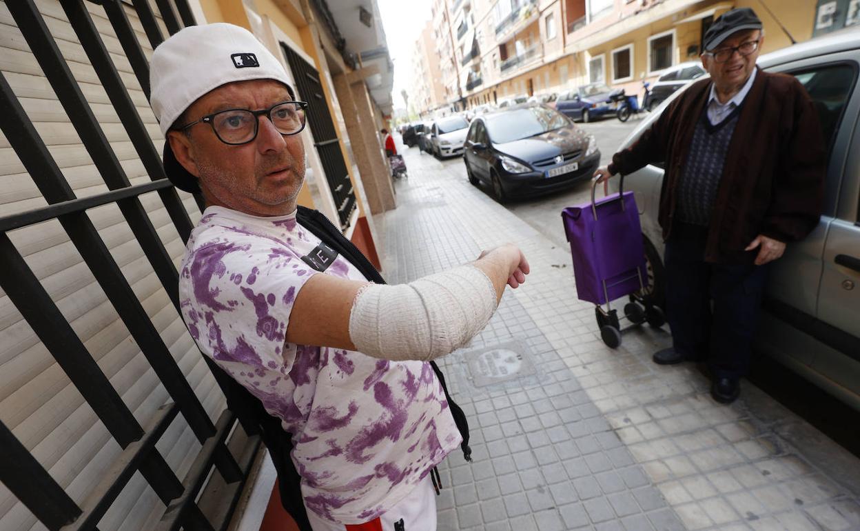 Julián Garde, una de las víctimas, muestra su lesión en el brazo a causa de la mordedura del perro. 