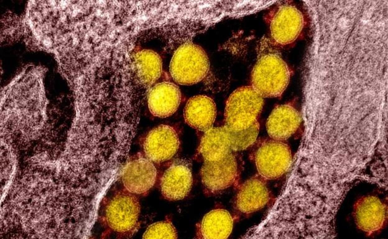 Imagen del coronavirus SARS-CoV-2, causante del COVID-19, tomada con microscopio electrónico. 