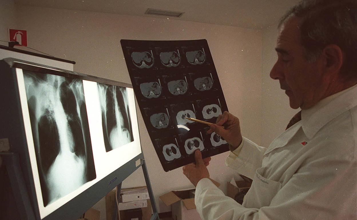 Un neumólogo analiza la radiografía de unos pulmones.