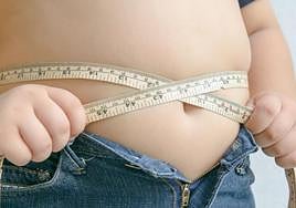 Una persona con obesidad.