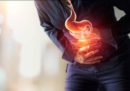 Qué es la enfermedad de Crohn: síntomas, causas y factores de riesgo