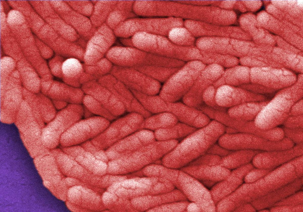 La bacteria de la salmonella vista por un microscopio.