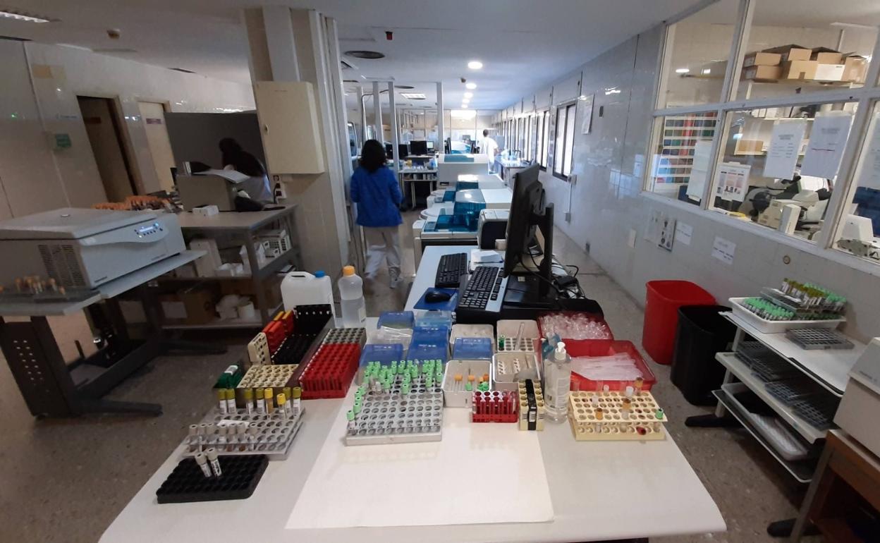 Laboratorio del hospital Lluís Alcanyís de Xàtiva. 