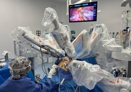 El hospital Arnau de Vilanova realiza con éxito la primera cirugía bariátrica asistida con el robot HUGO en España.