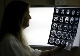 Una neuróloga observa radiografías de un feto, en una imagen de archivo.