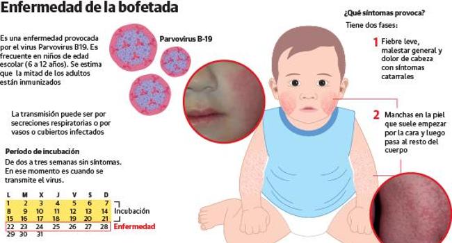 Así es el virus de la bofetada.