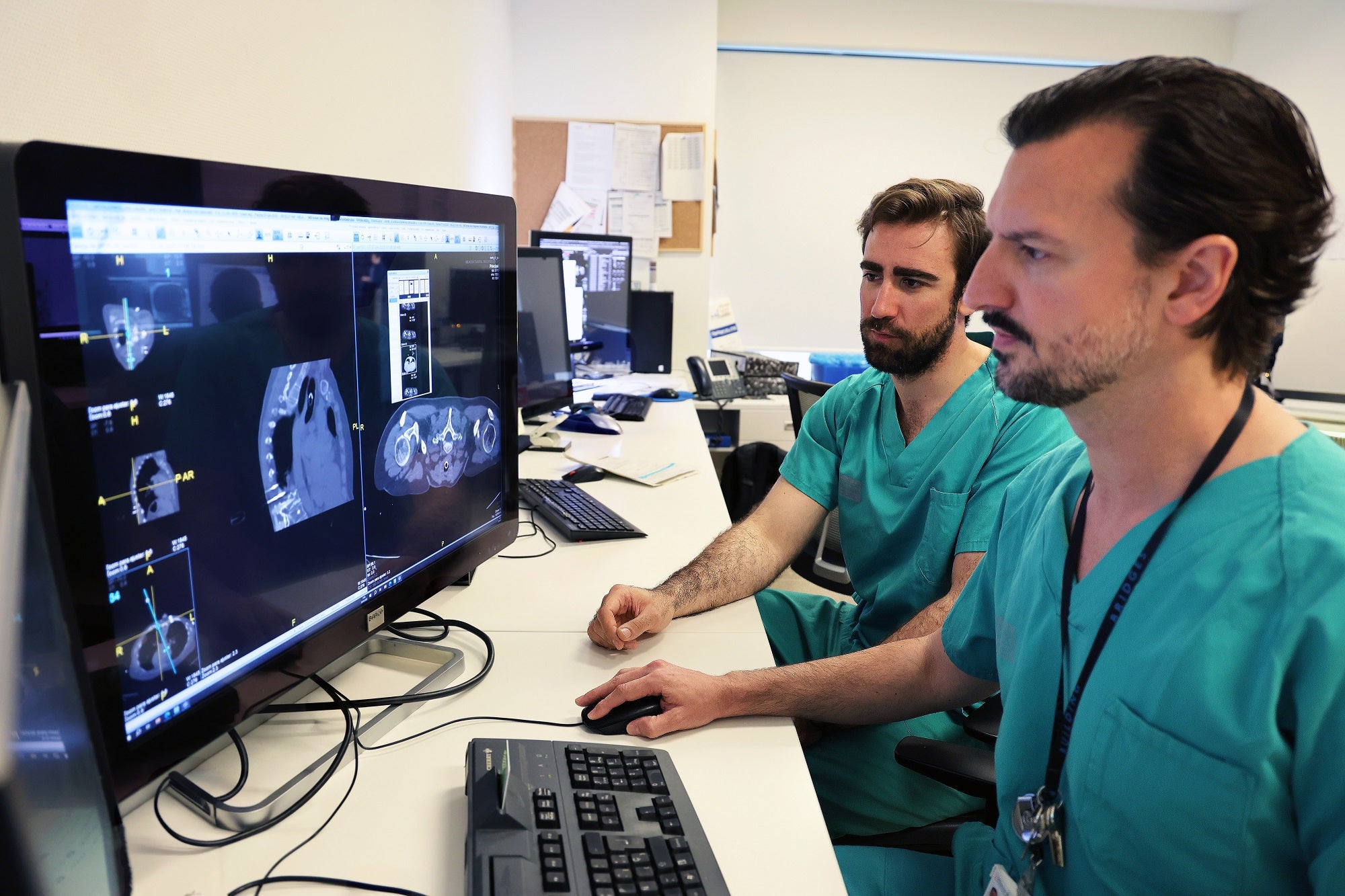 El hospital la fe, pionero en un tratamiento oncológico que permite concentrar fármacos directamente en el tumor | las provincias