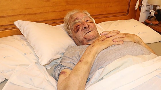 La detenida por la paliza a su tío de 89 años en Macastre para robarle 100 euros llevaba un cuchillo oculto