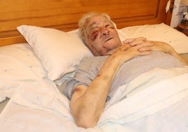 Vicente, de 89 años, se recupera en su domicilio de Macastre tras la brutal paliza.