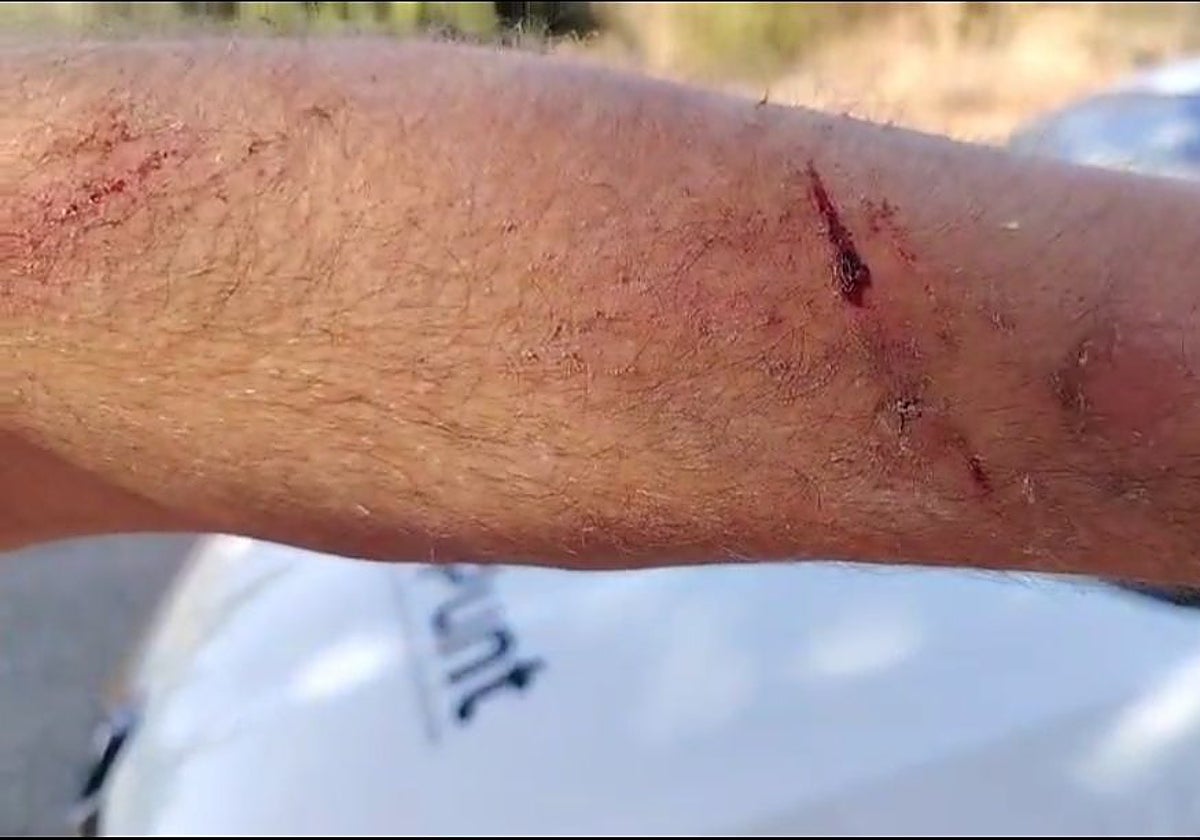 Agresiones en el brazo a un periodista de À Punt.