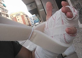 La mano vendada del funcionario agredido.