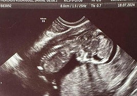 Ecografía de la pequeña Escarlett facilitada por su abuela.