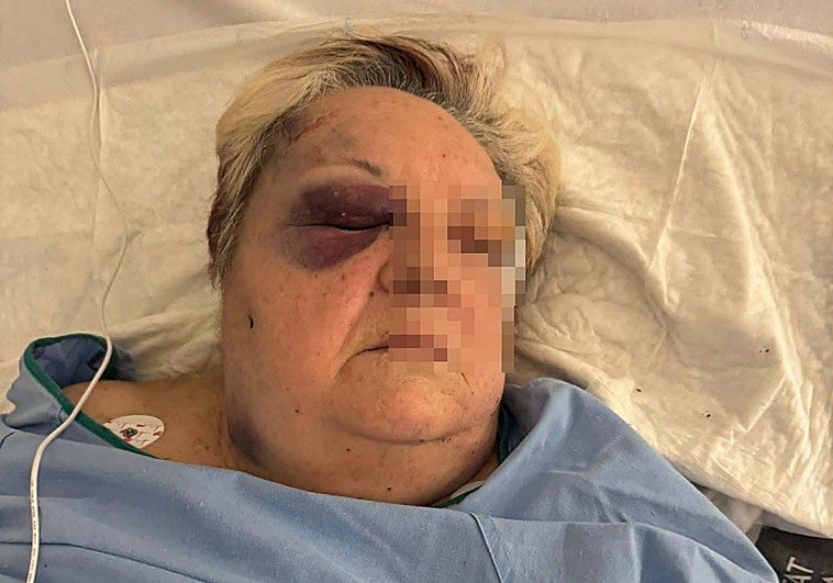 Agresión salvaje a una mujer de 71 años en Campanar por parte de dos jóvenes para robarle