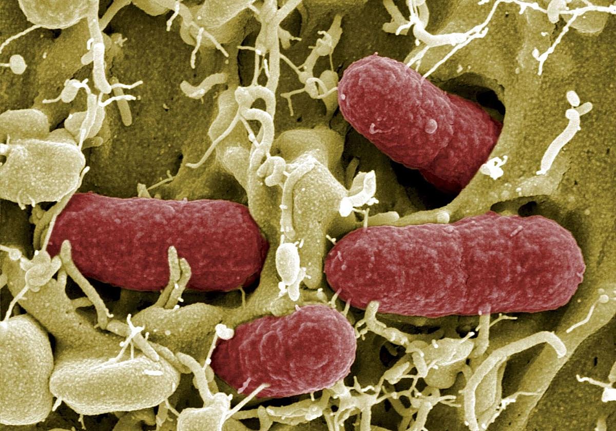Detalle de la bacteria ´E. coli´ aumentada al microscopio.