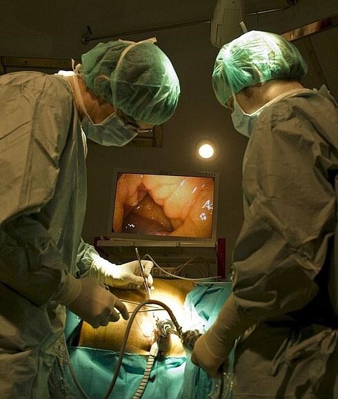 Cirujanos, en pleno trasplante.