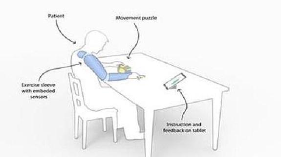 El dispositivo ayudará a los pacientes a mejorar el proceso de recuperación.