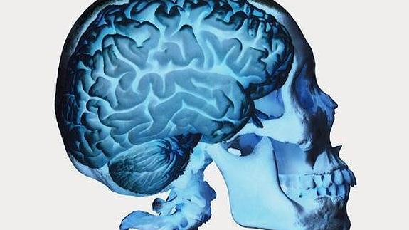 Los sensores ayudarían a una detección precoz de crisis epilécticas.