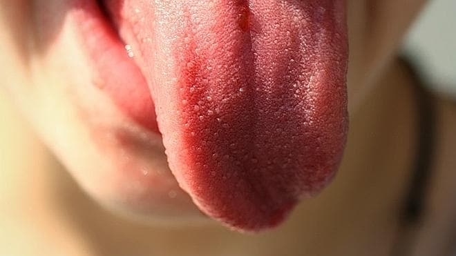 Progreso aleatorio diversión Tratamientos caseros para curar las llagas de la lengua | Las Provincias