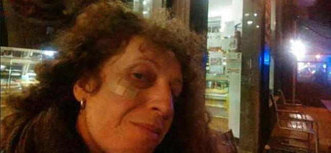 'Aída': Agreden a María Díaz González, La Junca, al confundirla con un travesti
