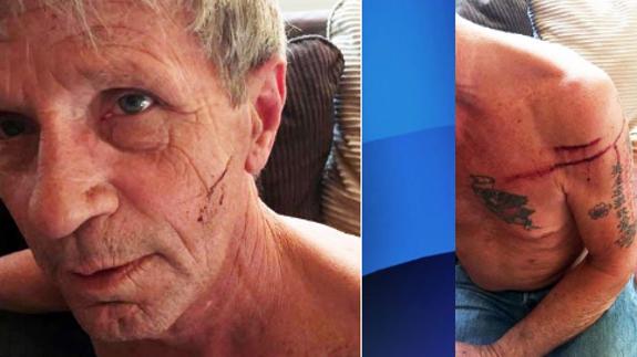 Un canadiense de 61 años boxea contra una osa y sólo sufre unos simples arañazos